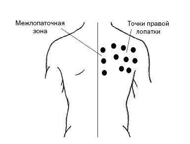 Правая точка. Болевые точки по лопаткой. Точечная боль в области правой лопатки. Точка под правой лопаткой. Точка под левой лопаткой.