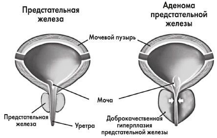 Железы мочевого пузыря. Анатомия мочевого пузыря, простата. Предстательная железа у собак анатомия. Мочевой пузырь и предстательная железа. Предстательная железа и уретра у мужчин.